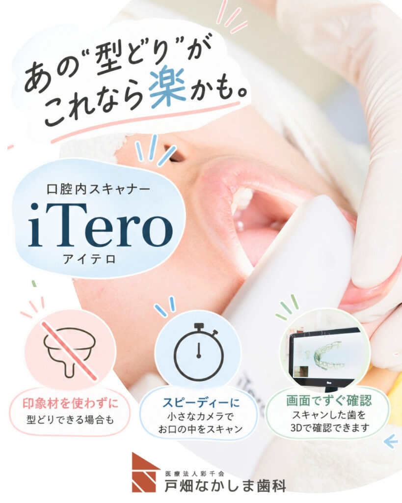 歯の型どりが苦手な方へ｜口腔内スキャナー「iTero（アイテロ）」を活用しています